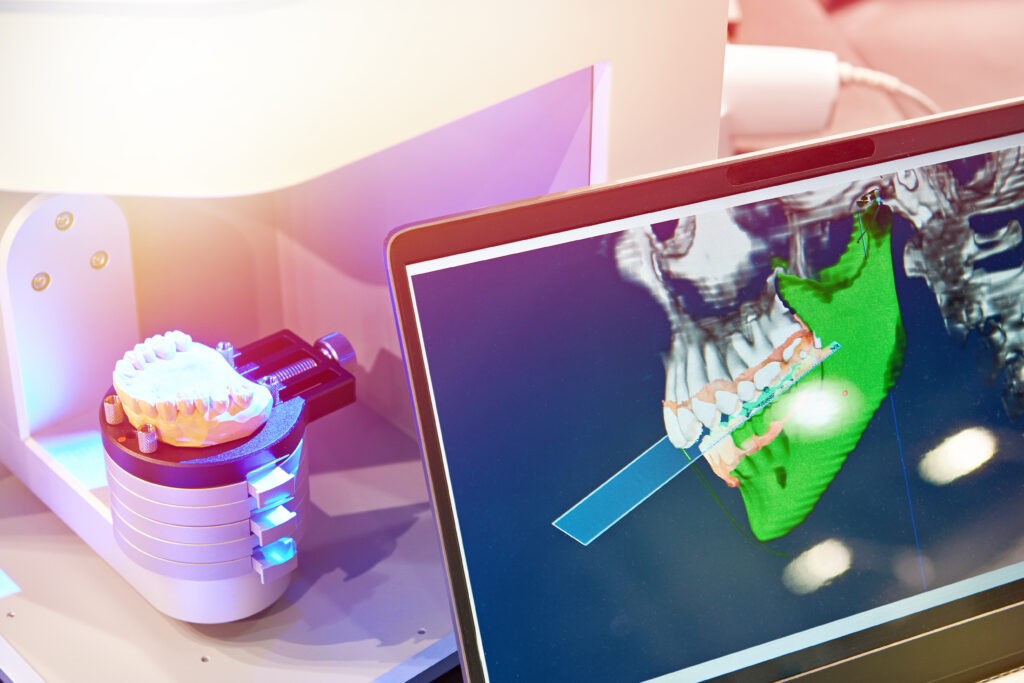 Functional Benefits Of Implant Dentures Kansas City, MO