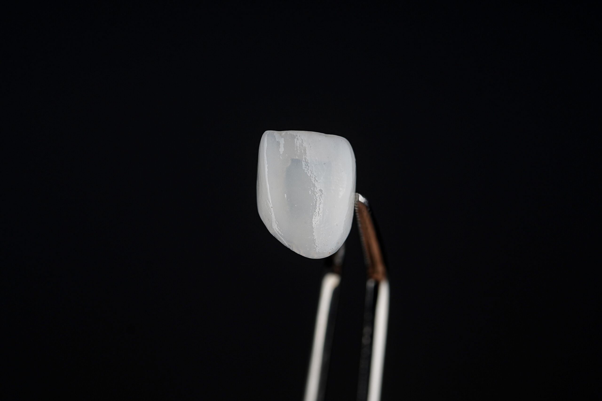 Veneers Offer Major Results Quickly Kansas City, MO