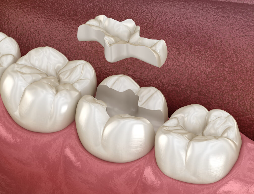 kansas city restorative dentistry