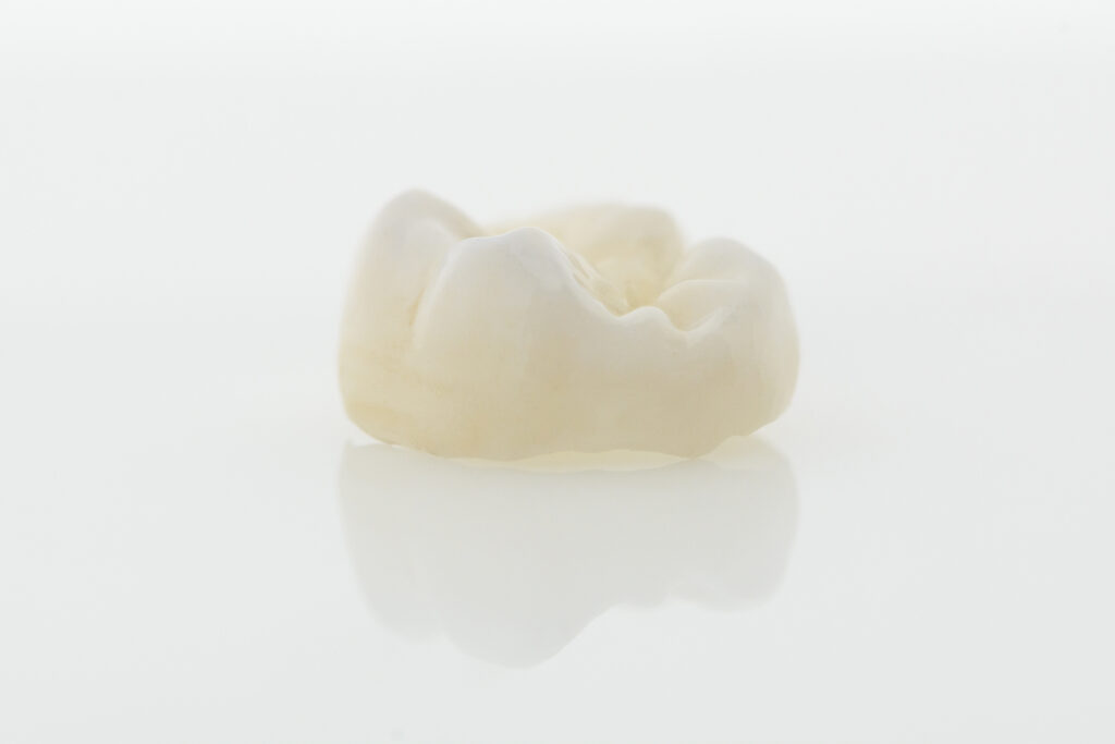 kansas city dental crowns