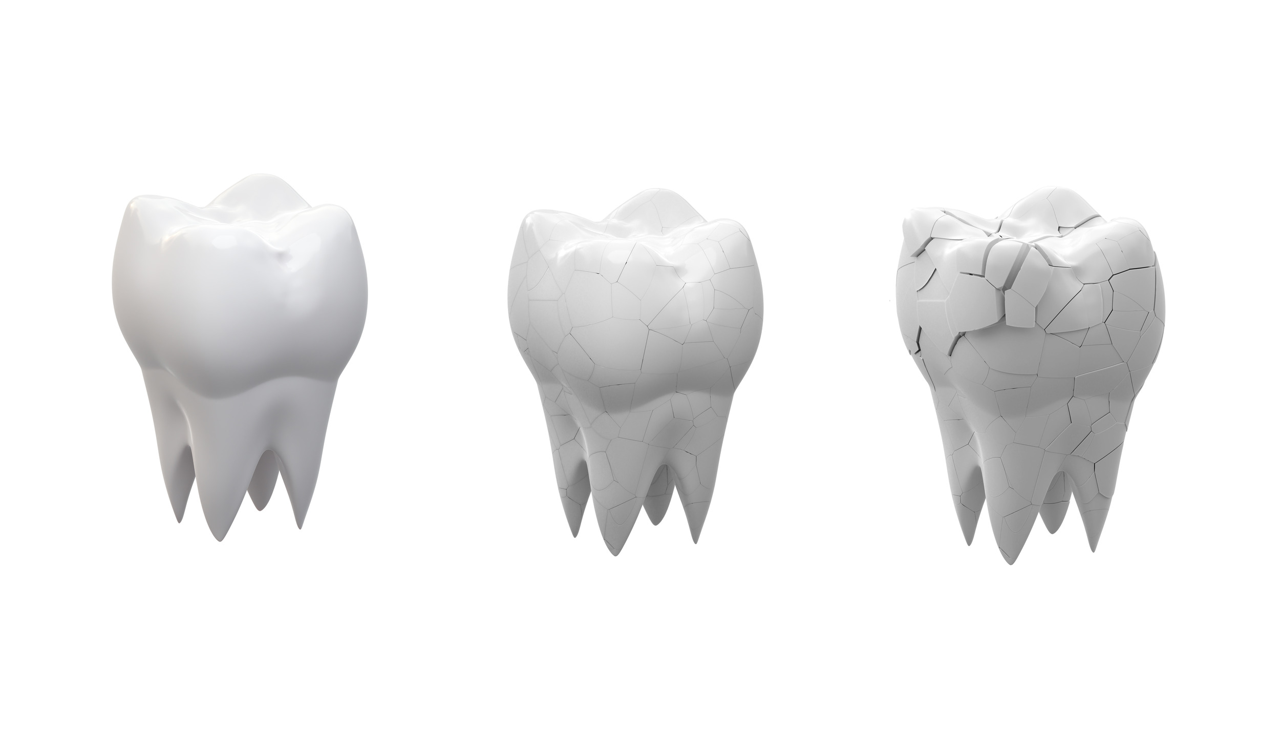 Time For Restorative Dentistry | Kansas City, MO