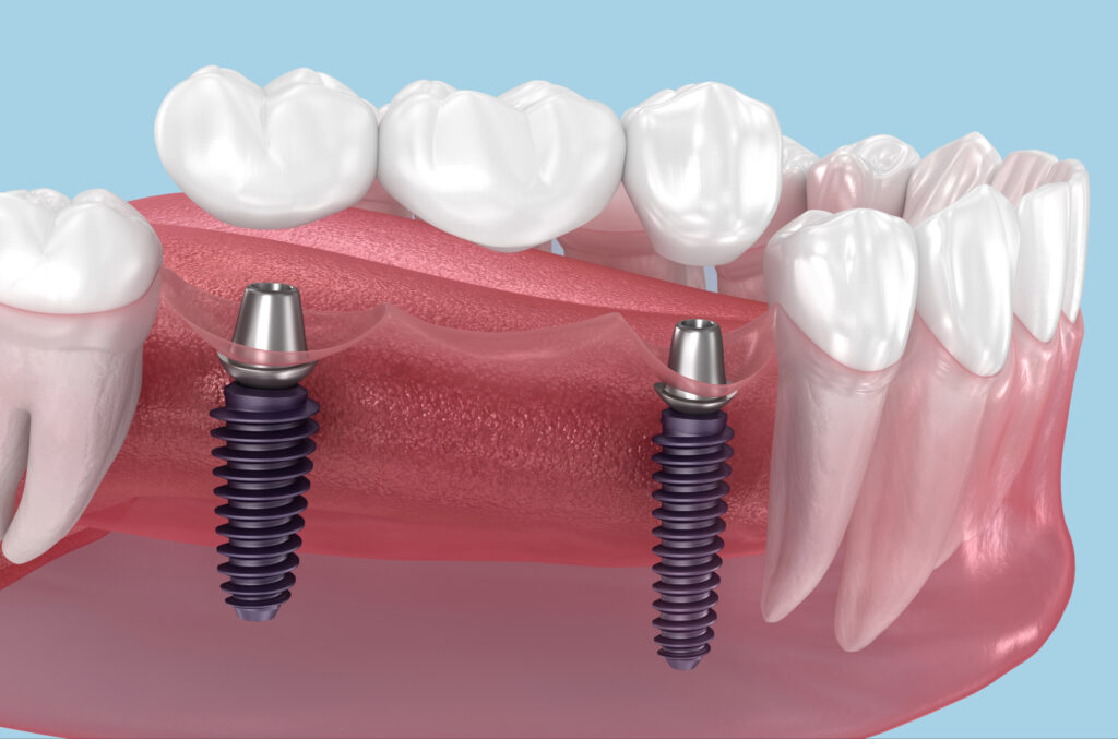 kansas city restorative dentistry